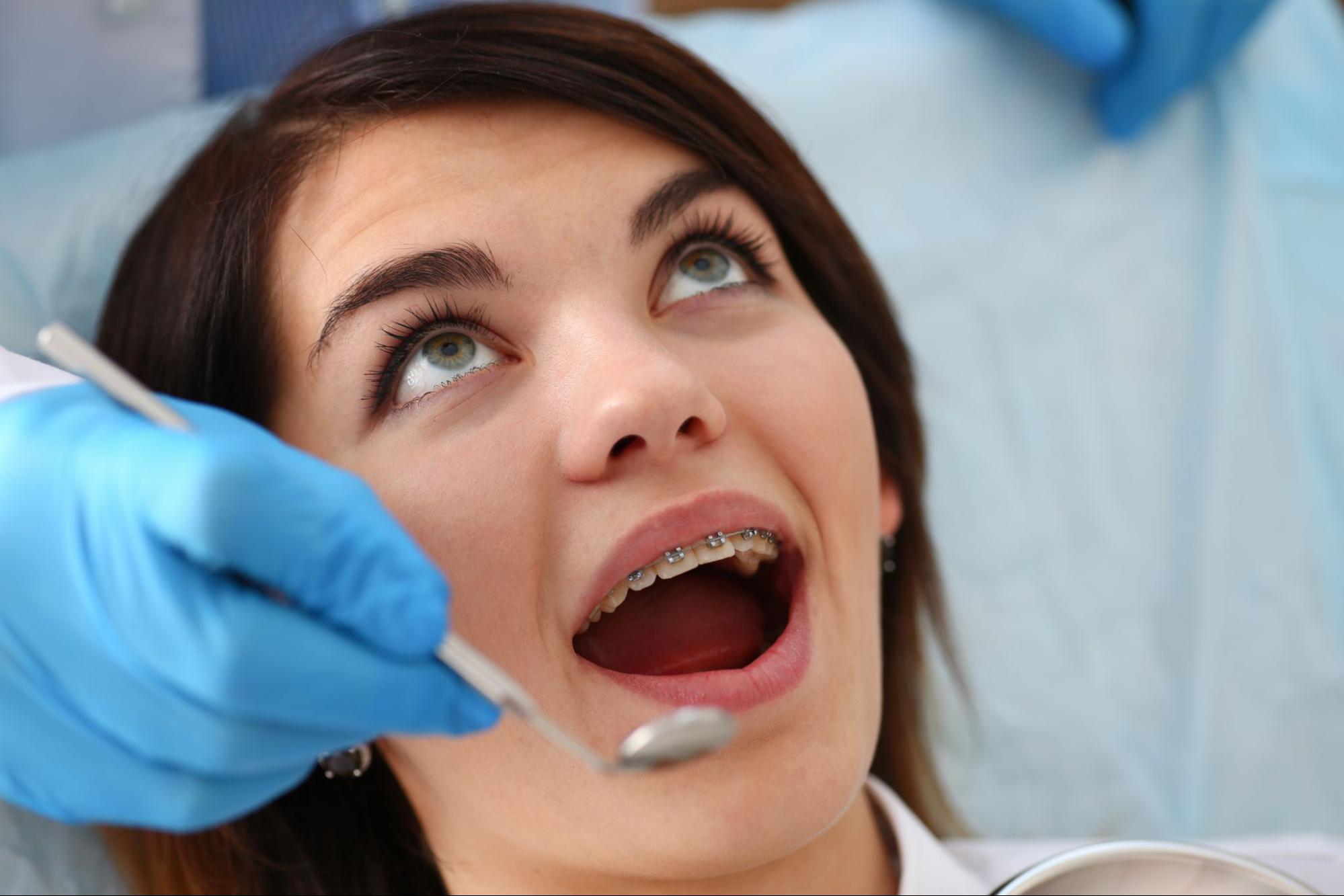What Happens During a Dental Cleaning?